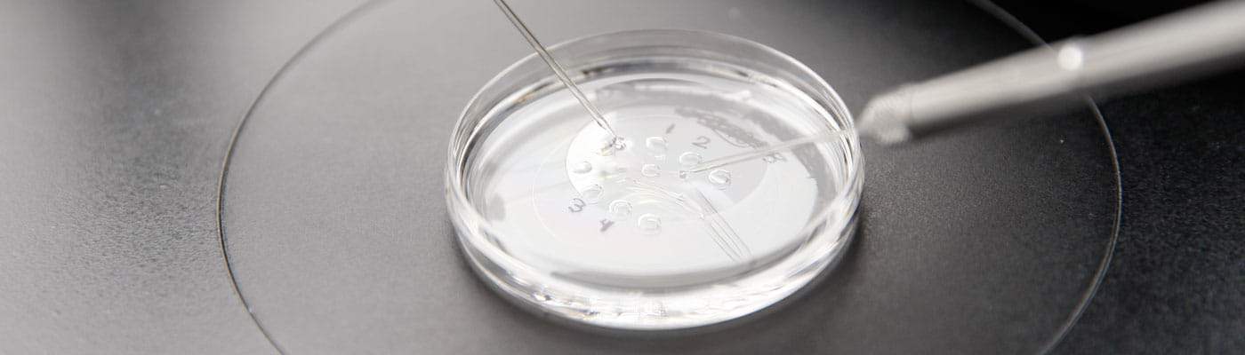 Why men choose semen analysis