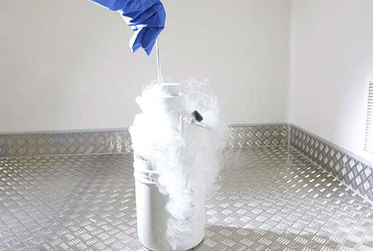 Sperm freezing