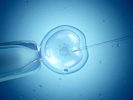The ICSI procedure