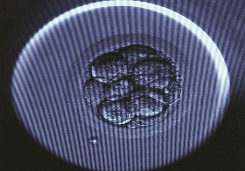 New IVF technique to look at pre-implantation embryos