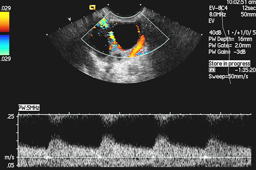 advanced ultrasound scan showing healthy ovary