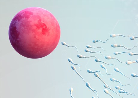 Infertility in men
