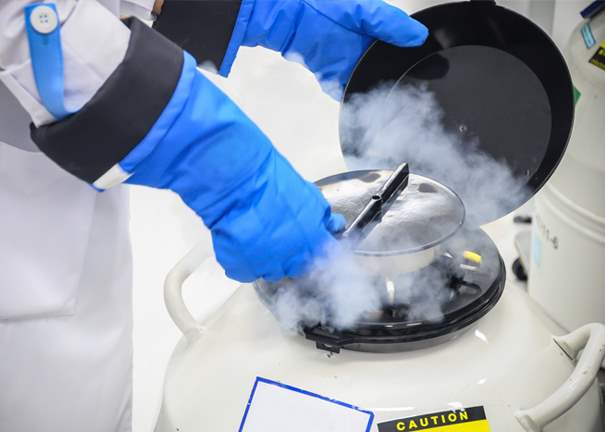 Sperm Freezing storage in liquid nitrogen tank