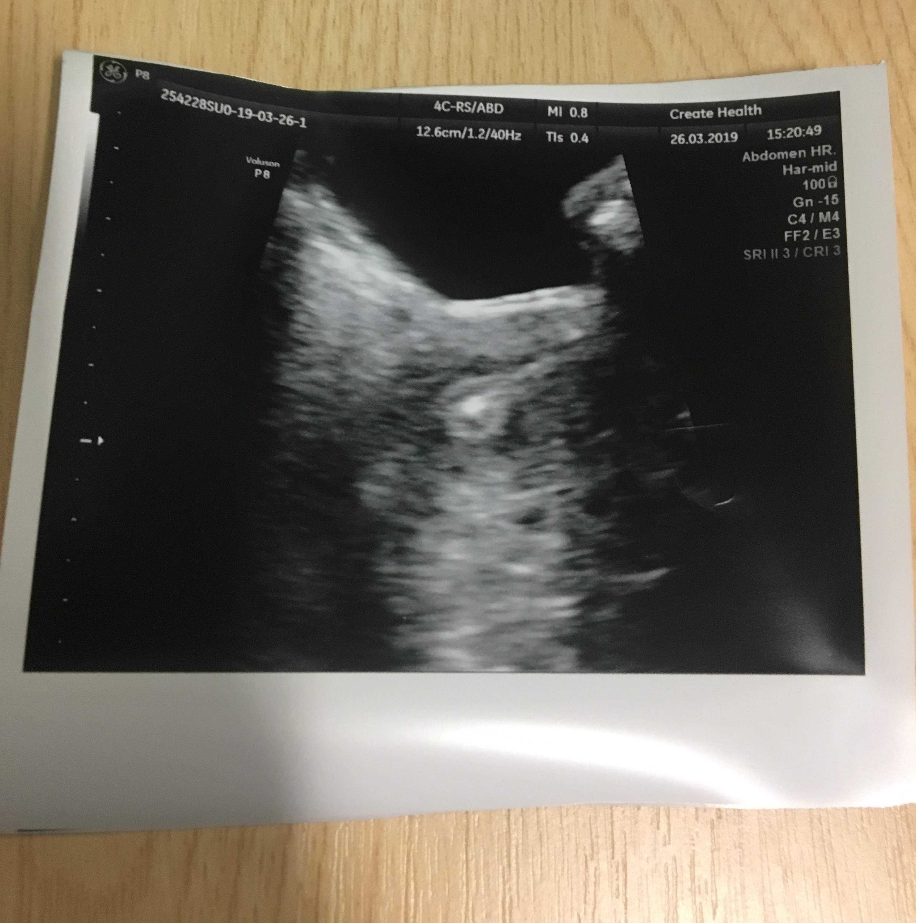 Ultrasound Scan Picture