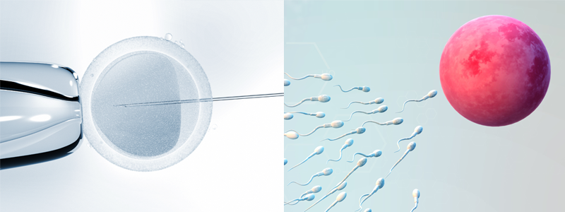 IUI vs IVF